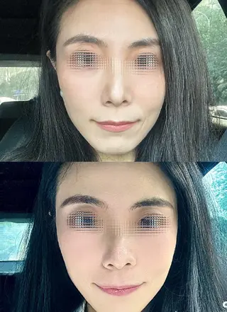 マツエク・マツパ aliaハイフ&水光ジェットサロン所属・aliaハーブ水光店 エステティシャン募集のエステ・リラクイメージ