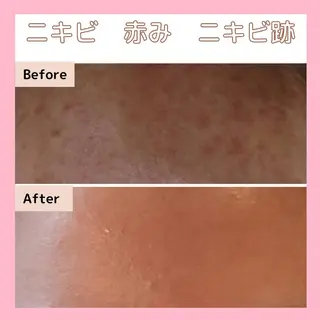 エステサロン　Sブランペタル所属・三沢市エステサロン Sブランペタルのエステ・リラクイメージ