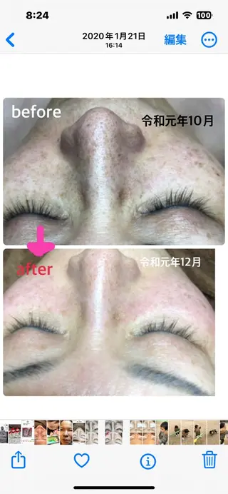 毛穴小顔・痩身サロン メイク・ド・ミュウのその他イメージ