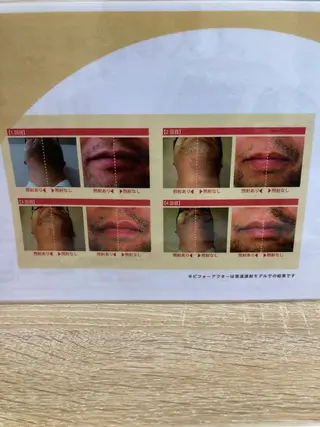 メンズ 矢野 つかさのマツエク・マツパデザイン