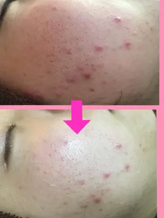 痩身リンパダイエット 隠れ家サロンチャームのエステ・リラクイメージ