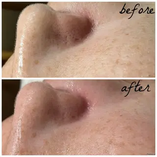 メンズ メナード岐阜市茜部 杉浦のエステ・リラクイメージ