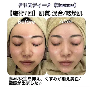 小顔&美肌品川店 Masqueradeのエステ・リラクイメージ