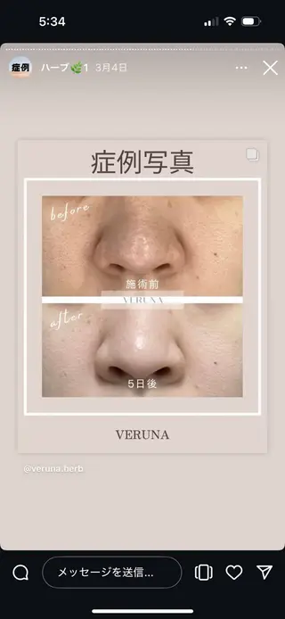 Grandir所属・ハーブピーリング専門 グランディール　武内のエステ・リラクイメージ