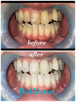 Salon de Béllému所属・Béllému ﾍﾞﾙｴﾐｭ　あおいのエステ・リラクイメージ