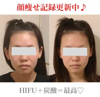 a  room salonのエステ・リラクイメージ