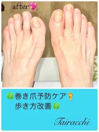 ネイル Tairacchi ﾀｲﾗｯﾁのエステ・リラクイメージ