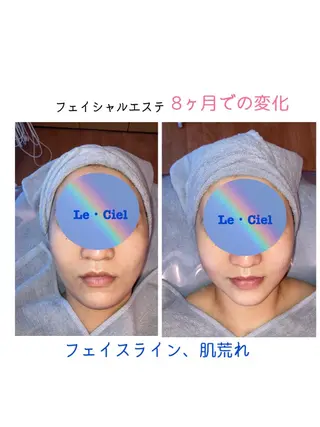 フェイシャルエステLe・Ciel所属・Le・Ciel フェイシャル&ボディのエステ・リラクイメージ