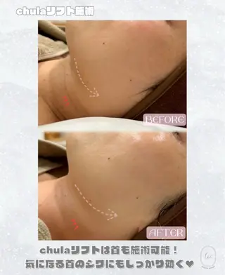 chulanail所属・arisa .のエステ・リラクイメージ