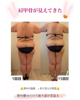 産後ダイエット−9㎏ Pourvous結衣のエステ・リラクイメージ