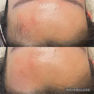 毛穴レス ハーブ＆ ワックス脱毛×光脱毛のエステ・リラクイメージ