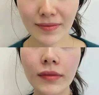 ショート カラー パーマ マツエク・マツパ aliaハイフ&水光ジェットサロン所属・aliaハーブ水光店 エステティシャン募集のエステ・リラクイメージ