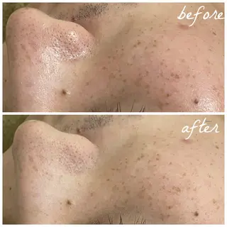 メンズ メナード岐阜茜部 杉浦のエステ・リラクイメージ