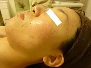 ピーリングサロン シャンテール所属・ピーリングサロン シャンテールのエステ・リラクイメージ