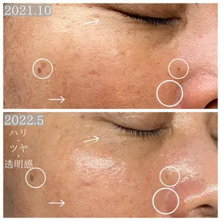 Bène Soin du Esthétique所属・逵中 元香のエステ・リラクイメージ