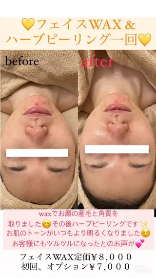 メンズ Salon de Lino 御器所のエステ・リラクイメージ