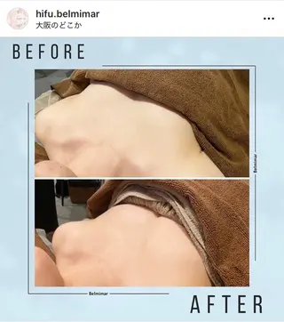 南森町・肌質改善 BELMIMARのエステ・リラクイメージ