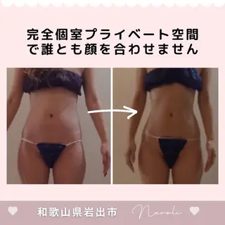温活beautyサロンNeroli所属・切らない脂肪吸引🔥 Neroliまりこのエステ・リラクイメージ