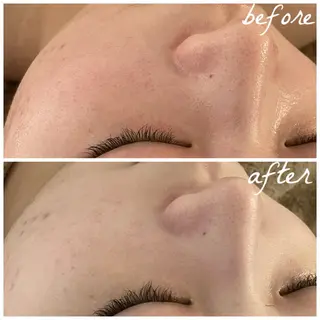 メンズ メナード岐阜茜部 杉浦のエステ・リラクイメージ