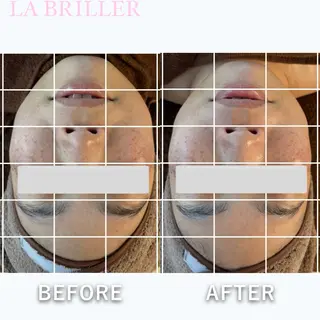 LA BRILLERのエステ・リラクイメージ