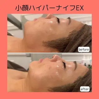 赤澤/本気痩せ・脱毛 ・ノーファンデ肌のその他イメージ