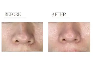 肩こり・むくみ解消専門店　ながれるオイルリンパ Ranun 恵比寿店所属・石黒 美帆のエステ・リラクイメージ