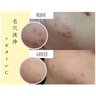 肌ケア&毛穴洗浄 Cheriのエステ・リラクイメージ