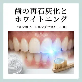 ショート ホワイトニングサロン nico西葛西店のその他イメージ