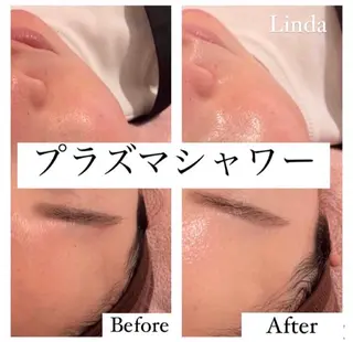 アイラッシュ&エステサロンLinda西宮所属・小顔&毛穴・肌質改善 LINDA西宮 AIのエステ・リラクイメージ