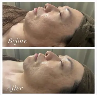 HAKUBI フェイシャルサロンのエステ・リラクイメージ