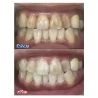 M渋谷店所属・M渋谷 ホワイトニングのエステ・リラクイメージ