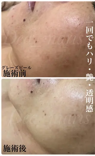 private salon  Dea_maris シュガーリング＆パーソナルボディケア所属・シミ改善・韓国肌管理 ボディメイク痩身のその他イメージ