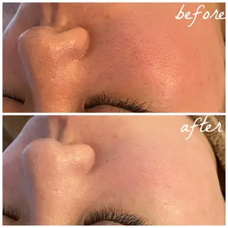 メンズ メナード岐阜市茜部 杉浦のエステ・リラクイメージ