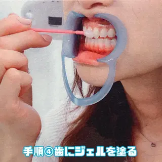 LBSホワイトニング 🌐渋谷店スタッフのエステ・リラクイメージ