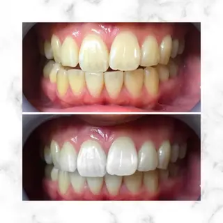 LBSホワイトニング 🌐渋谷店スタッフのエステ・リラクイメージ