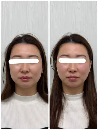 美容鍼×小顔矯正 ×美容整体　浜川泰仁のエステ・リラクイメージ