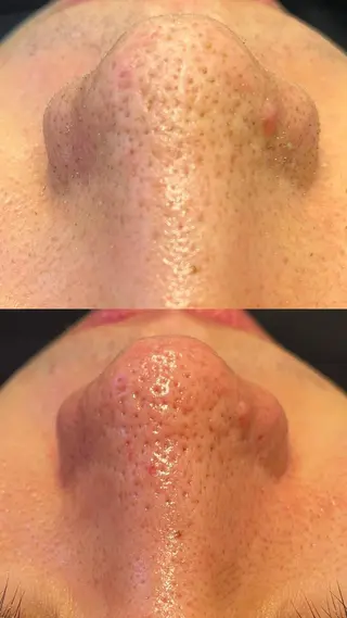 Lilyboo 池袋のエステ・リラクイメージ