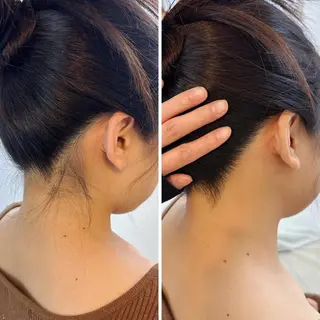 うなじ脱毛/美肌脱毛 LABELのエステ・リラクイメージ