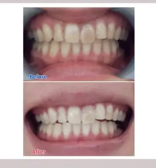 M渋谷店所属・M渋谷 ホワイトニングのエステ・リラクイメージ