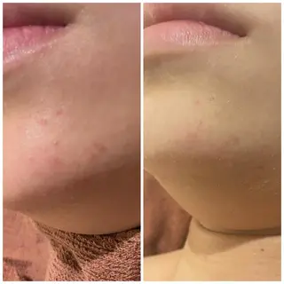 ロング カラー パーマ ヘアアレンジ メンズ キッズ ネイル マツエク・マツパ アイブロウ ニキビ特化型エステ 🍓最短で肌質改善のエステ・リラクイメージ