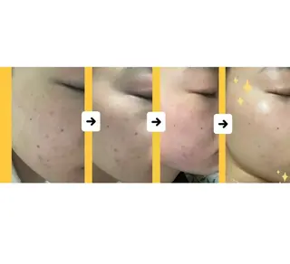 フェイシャルエステ 🌼肌改善🫧のエステ・リラクイメージ