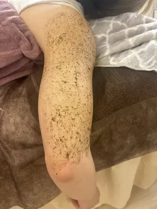 ハーブピーリング/韓国肌管理/フェイシャル/毛穴洗浄/眉毛/顔脱毛【糸脱毛専門】rev所属・ハーブピーリング🌹 毛穴洗浄❤️眉waxのエステ・リラクイメージ