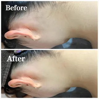 脱毛サロン fam.豊澤柚良のエステ・リラクイメージ