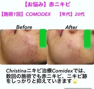 小顔&美肌品川店 Masqueradeのエステ・リラクイメージ