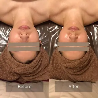 小顔🌼💕肌質改善 SalonBelleのエステ・リラクイメージ