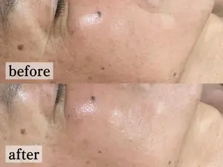 フェイシャル/脱毛 ジョアアンジェ竹田のエステ・リラクイメージ