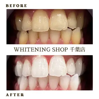 メンズ ホワイトニング ショップ千葉店のその他イメージ
