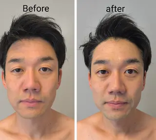 メンズ ECLAT所属・プライベートサロン✢ Eclatエクラ　のエステ・リラクイメージ