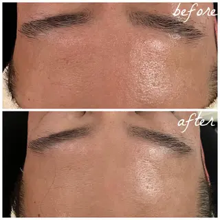 メンズ メナード岐阜市茜部 杉浦のエステ・リラクイメージ