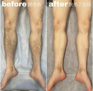 メンズ Ikuta Youの眉毛・アイブロウイメージ